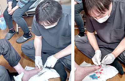 形成外科専門医による処置